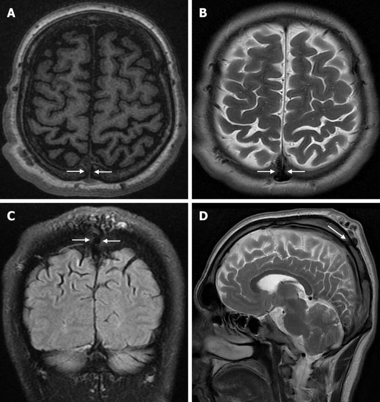 https://cdn.ncbi.nlm.nih.gov/pmc/blobs/a405/12210201/feb3f2fe6f41/wjr-17-6-107776-g007.jpg