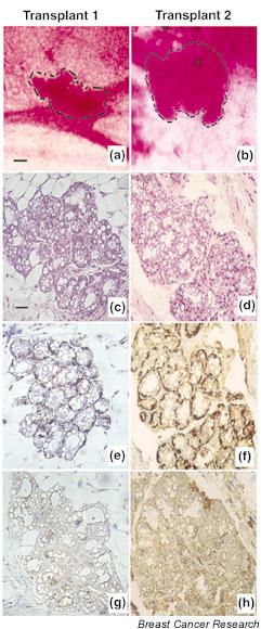 https://cdn.ncbi.nlm.nih.gov/pmc/blobs/a408/154129/564661baf525/bcr547-3.jpg