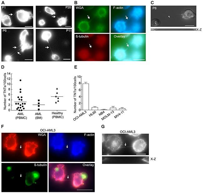 https://cdn.ncbi.nlm.nih.gov/pmc/blobs/a40d/5352373/a41645208ee8/oncotarget-08-7946-g001.jpg