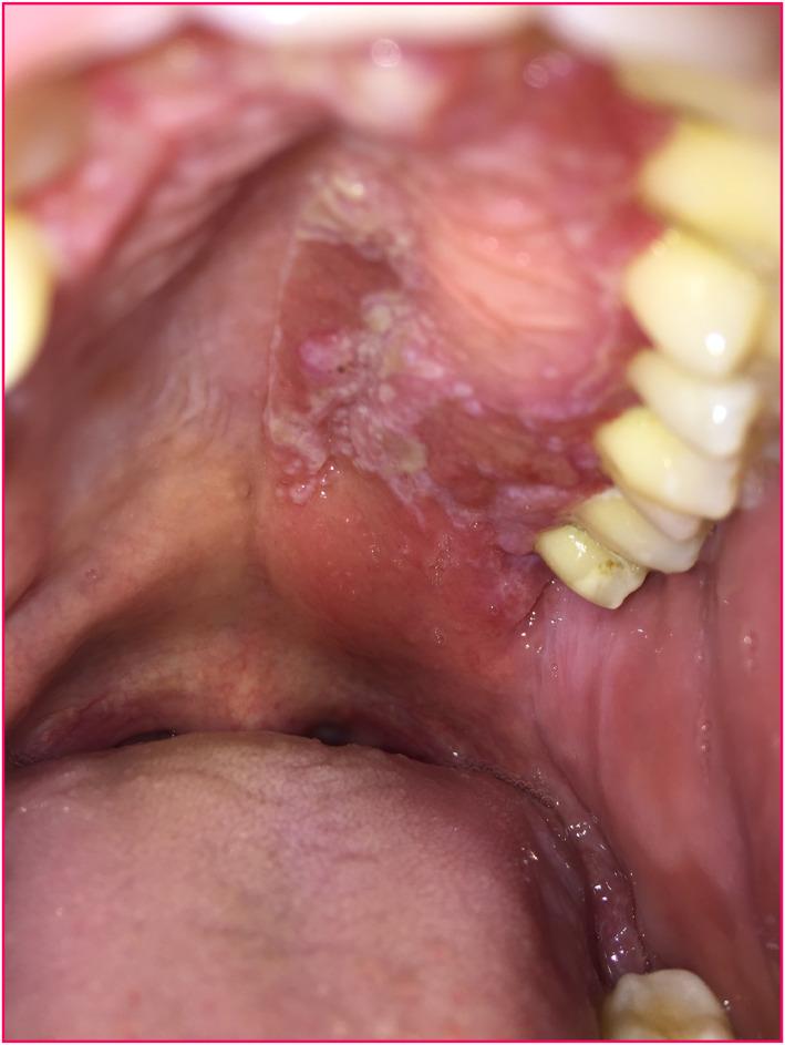 https://cdn.ncbi.nlm.nih.gov/pmc/blobs/a40e/12188349/f8f7cfcf4583/UEG2-13-674-g002.jpg