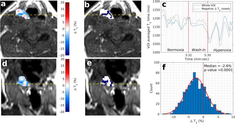 https://cdn.ncbi.nlm.nih.gov/pmc/blobs/a40f/10914657/06ad8b84c680/41747_2024_429_Fig5_HTML.jpg
