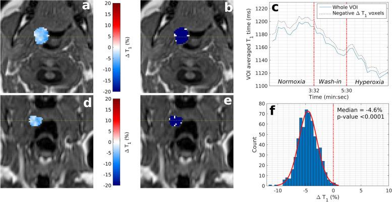 https://cdn.ncbi.nlm.nih.gov/pmc/blobs/a40f/10914657/2d498d4d4643/41747_2024_429_Fig4_HTML.jpg
