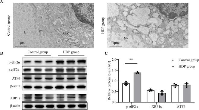 https://cdn.ncbi.nlm.nih.gov/pmc/blobs/a411/12380578/3860942afc5c/fendo-16-1552065-g005.jpg