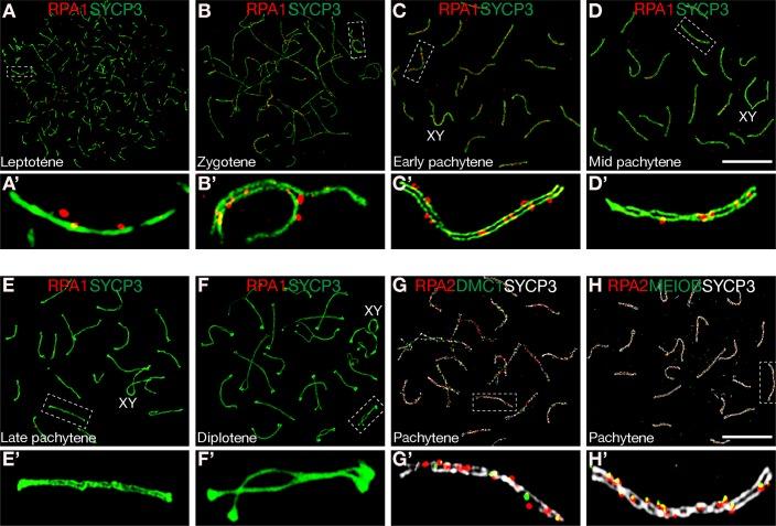 https://cdn.ncbi.nlm.nih.gov/pmc/blobs/a412/6375638/566b3dd1e22f/pgen.1007952.g001.jpg
