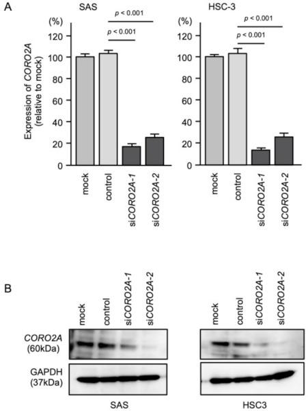 https://cdn.ncbi.nlm.nih.gov/pmc/blobs/a420/8657730/764ab4ae63e5/ijms-22-12684-g005.jpg