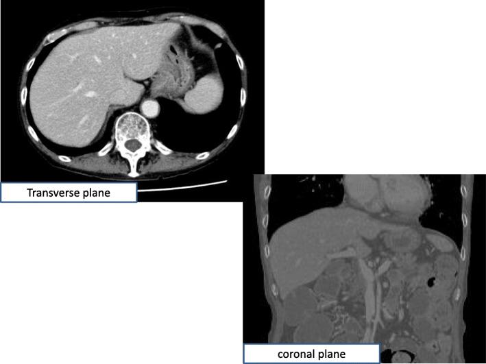 https://cdn.ncbi.nlm.nih.gov/pmc/blobs/a42e/7689984/f1618a45bd06/13256_2020_2541_Fig2_HTML.jpg