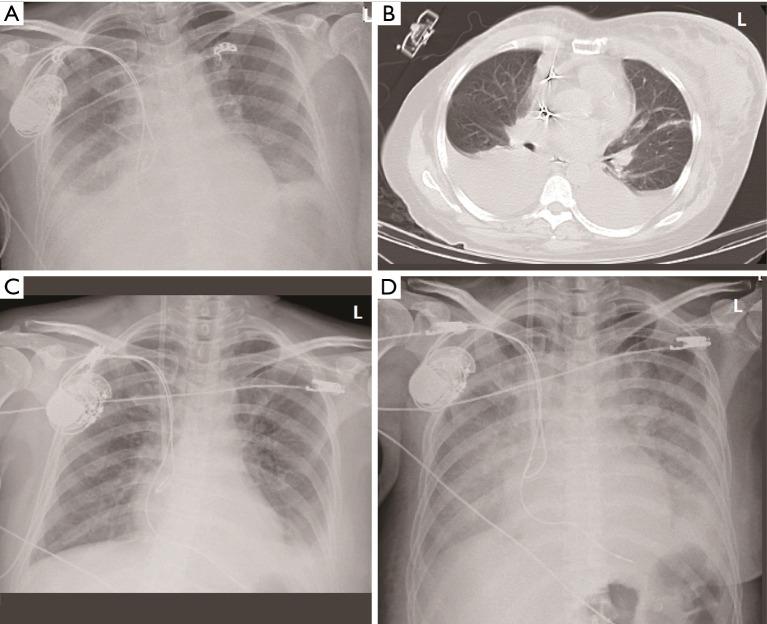 https://cdn.ncbi.nlm.nih.gov/pmc/blobs/a440/12319590/08e67ba9600e/acr-09-24-247-f1.jpg