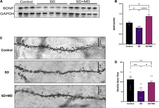 https://cdn.ncbi.nlm.nih.gov/pmc/blobs/a443/8927040/20d7fdab055a/fnins-16-816752-g006.jpg