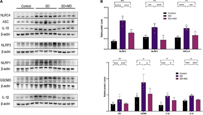 https://cdn.ncbi.nlm.nih.gov/pmc/blobs/a443/8927040/6a7d40e4a7e4/fnins-16-816752-g003.jpg