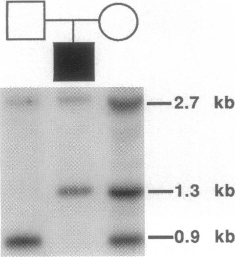 https://cdn.ncbi.nlm.nih.gov/pmc/blobs/a44f/1712560/8921f3c19527/ajhg00001-0143-a.jpg