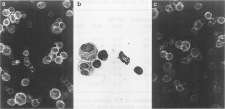 https://cdn.ncbi.nlm.nih.gov/pmc/blobs/a455/2013270/e2a106d6890d/brjexppathol00005-0013-a.jpg