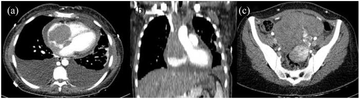 https://cdn.ncbi.nlm.nih.gov/pmc/blobs/a468/8793420/561db82cc65b/10.1177_2050313X211070942-fig2.jpg