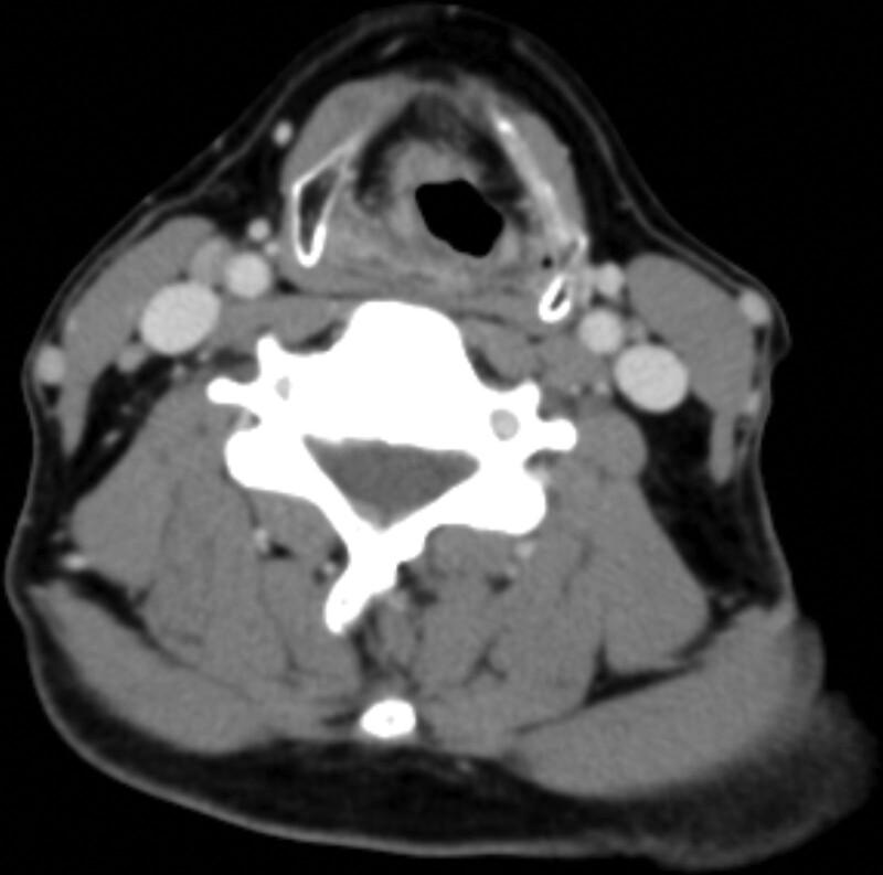 https://cdn.ncbi.nlm.nih.gov/pmc/blobs/a469/11155512/1ff9680c4133/medi-103-e38427-g001.jpg