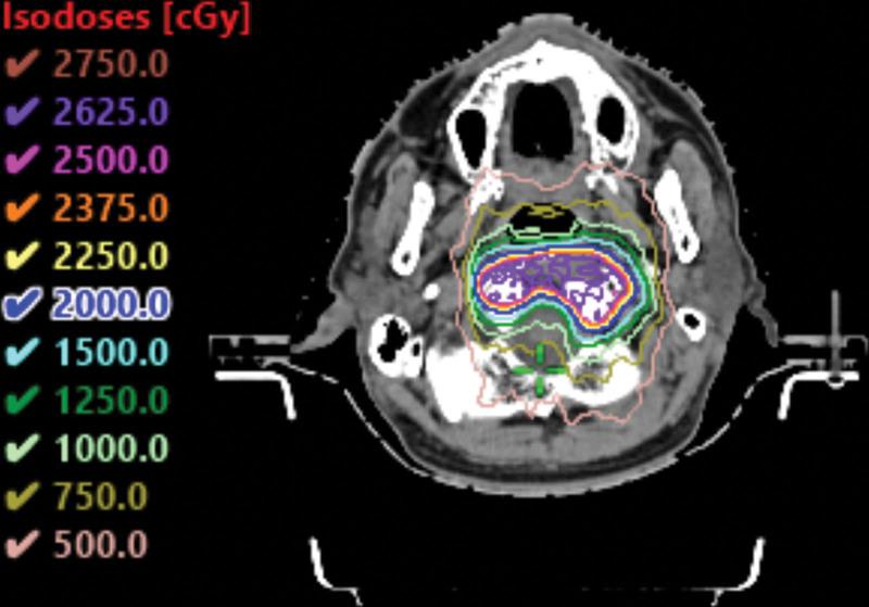 https://cdn.ncbi.nlm.nih.gov/pmc/blobs/a469/11155512/bd562132dcdb/medi-103-e38427-g007.jpg