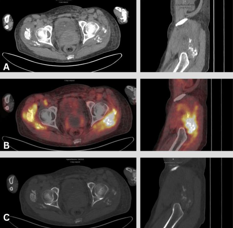 https://cdn.ncbi.nlm.nih.gov/pmc/blobs/a46a/11144052/614e471481cf/cureus-0016-00000059520-i02.jpg