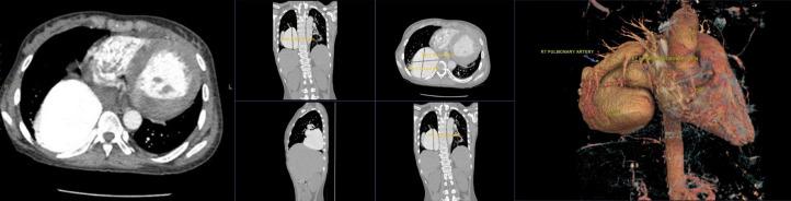 https://cdn.ncbi.nlm.nih.gov/pmc/blobs/a475/12365801/7bb9087a81de/gr2.jpg