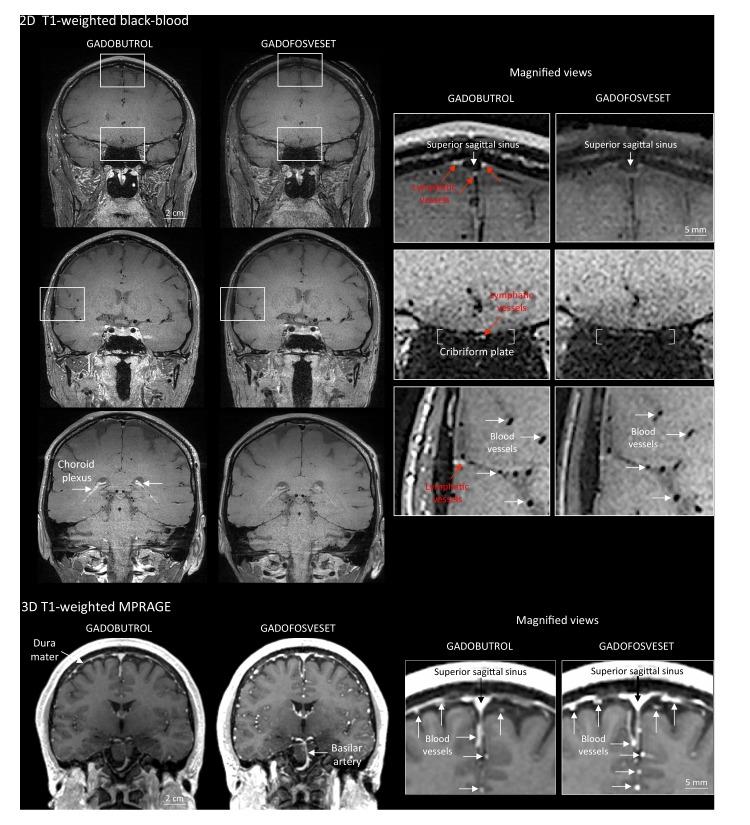 https://cdn.ncbi.nlm.nih.gov/pmc/blobs/a479/5626482/b46eaed5647e/elife-29738-fig2.jpg