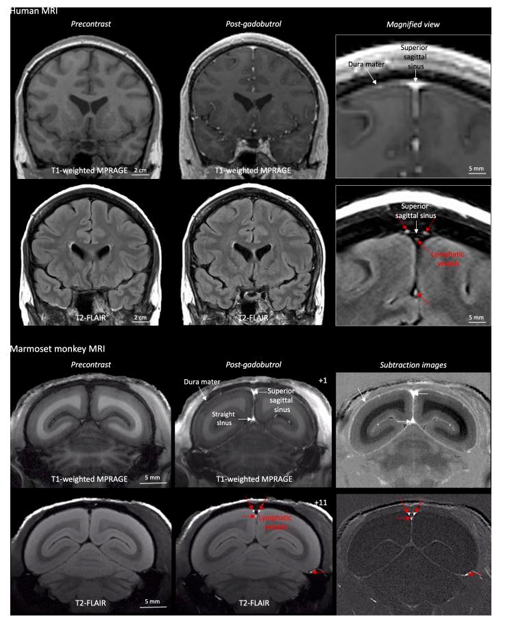 https://cdn.ncbi.nlm.nih.gov/pmc/blobs/a479/5626482/b47f4c175d44/elife-29738-fig1.jpg