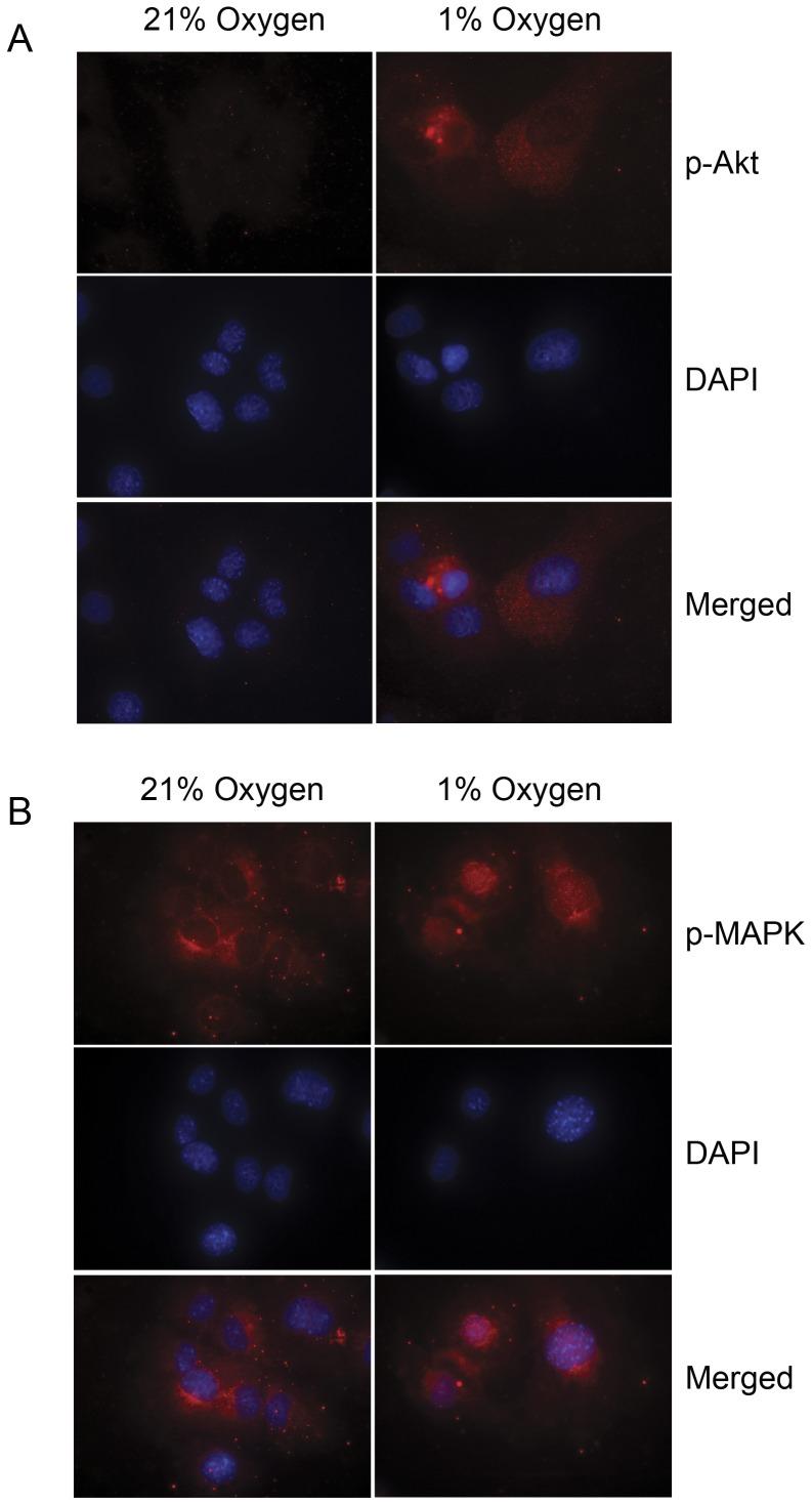 https://cdn.ncbi.nlm.nih.gov/pmc/blobs/a47a/3390334/00898578fa03/pone.0040243.g006.jpg