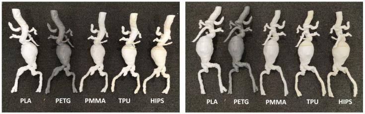 https://cdn.ncbi.nlm.nih.gov/pmc/blobs/a47b/9959835/96d9416871e9/micromachines-14-00464-g012.jpg