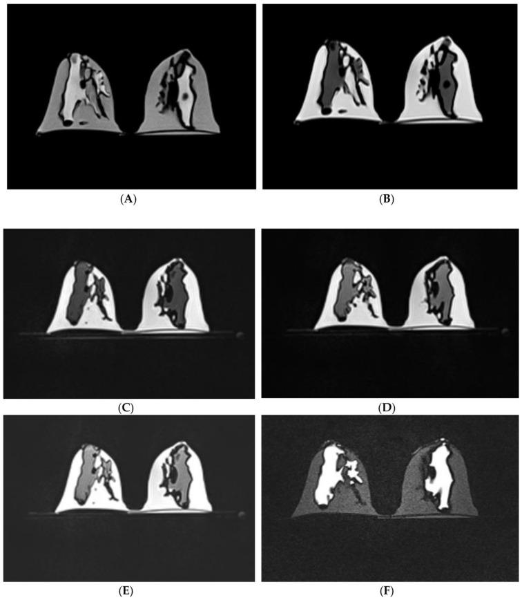 https://cdn.ncbi.nlm.nih.gov/pmc/blobs/a47b/9959835/c2999f37812b/micromachines-14-00464-g017.jpg