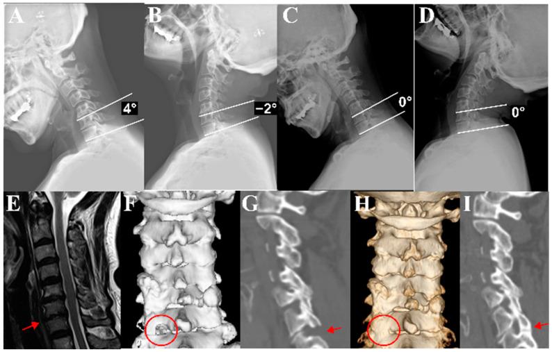 https://cdn.ncbi.nlm.nih.gov/pmc/blobs/a47c/11433765/b275749ce80a/medicina-60-01496-g003.jpg