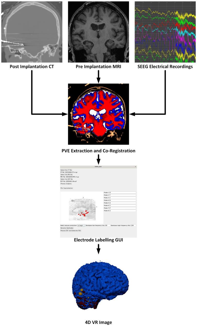 https://cdn.ncbi.nlm.nih.gov/pmc/blobs/a484/11405301/8a6748cc55d3/fninf-18-1465231-g001.jpg