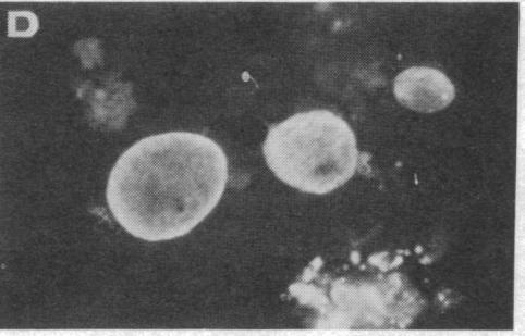 https://cdn.ncbi.nlm.nih.gov/pmc/blobs/a48b/411387/b887bcdbe40d/pnas00014-0473-c.jpg