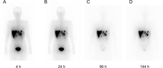 https://cdn.ncbi.nlm.nih.gov/pmc/blobs/a48c/11604894/1406590a50c6/13550_2024_1185_Fig1_HTML.jpg