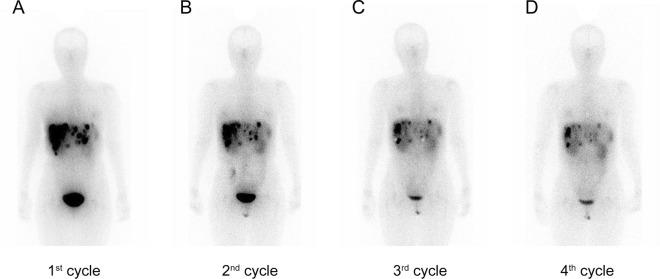 https://cdn.ncbi.nlm.nih.gov/pmc/blobs/a48c/11604894/65c7269c3de9/13550_2024_1185_Fig2_HTML.jpg