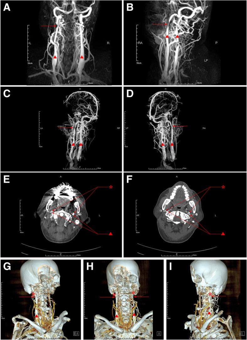 https://cdn.ncbi.nlm.nih.gov/pmc/blobs/a48c/6549290/a5650b93da6a/12883_2019_1344_Fig4_HTML.jpg