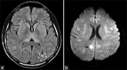https://cdn.ncbi.nlm.nih.gov/pmc/blobs/a49a/4563975/3a23502c5781/AER-9-273-g002.jpg