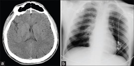 https://cdn.ncbi.nlm.nih.gov/pmc/blobs/a49a/4563975/5f881098dea8/AER-9-273-g001.jpg