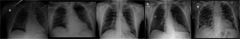 https://cdn.ncbi.nlm.nih.gov/pmc/blobs/a4ab/7680818/8b0770fd5d4b/13755_2020_135_Fig2_HTML.jpg