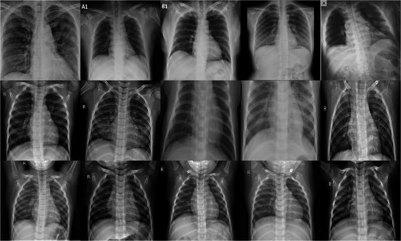 https://cdn.ncbi.nlm.nih.gov/pmc/blobs/a4ab/7680818/9b8fa88c4398/13755_2020_135_Fig1_HTML.jpg