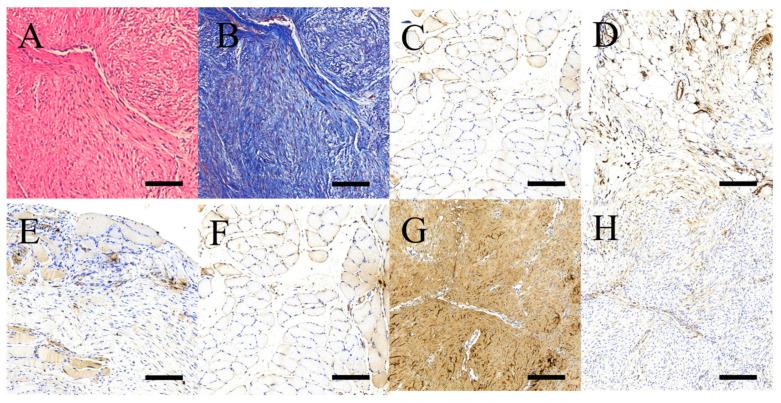 https://cdn.ncbi.nlm.nih.gov/pmc/blobs/a4b5/10671766/2f00cd6893a8/ijms-24-16235-g005.jpg