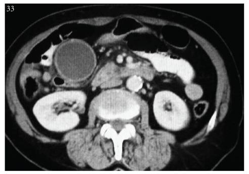 https://cdn.ncbi.nlm.nih.gov/pmc/blobs/a4b8/3114376/4262c4fd1e59/CRIM2011-173036.001.jpg