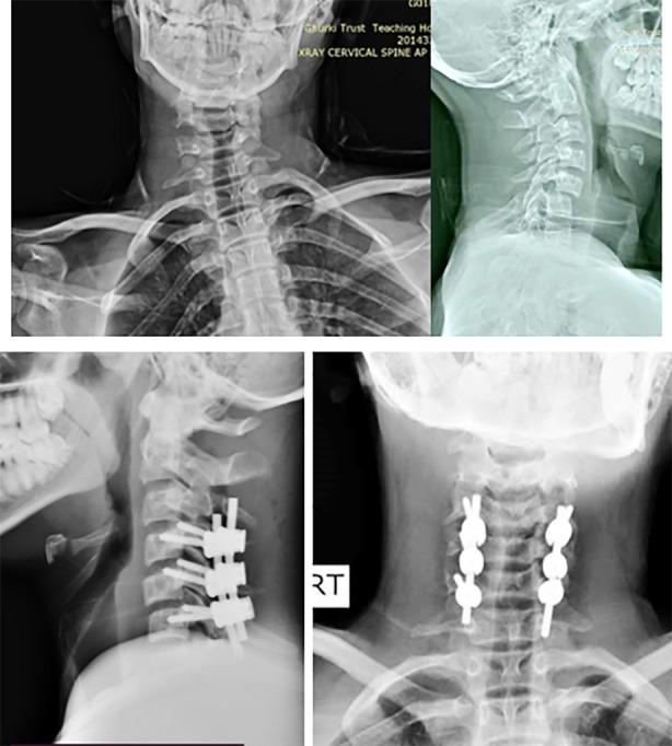 https://cdn.ncbi.nlm.nih.gov/pmc/blobs/a4bc/12022558/5ca240b776e3/PJMS-41-1019-g003.jpg