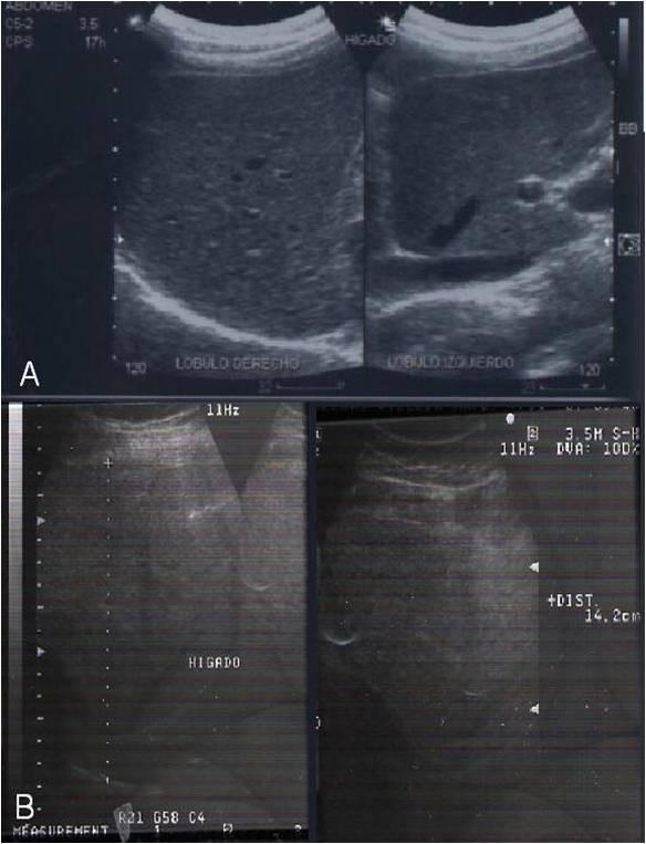 https://cdn.ncbi.nlm.nih.gov/pmc/blobs/a4c2/2861069/4b487f3886f8/1752-1947-4-103-2.jpg