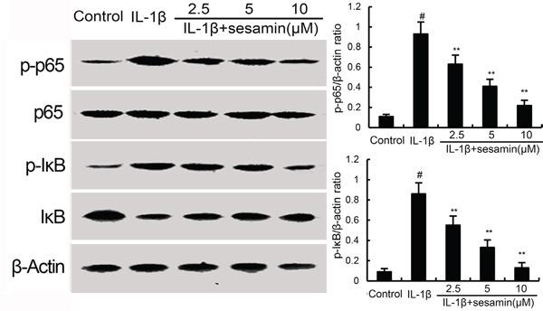 https://cdn.ncbi.nlm.nih.gov/pmc/blobs/a4c4/5347798/df933c785854/oncotarget-07-83720-g004.jpg