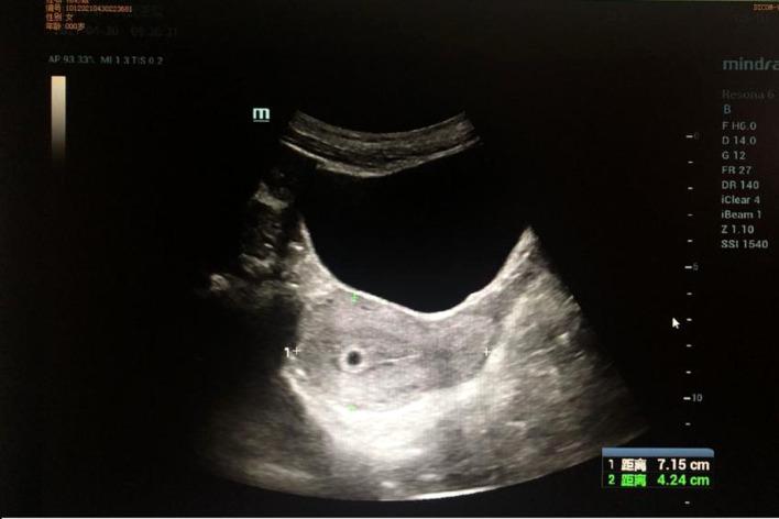 https://cdn.ncbi.nlm.nih.gov/pmc/blobs/a4ca/9905710/b6f853691401/fonc-13-1066153-g005.jpg