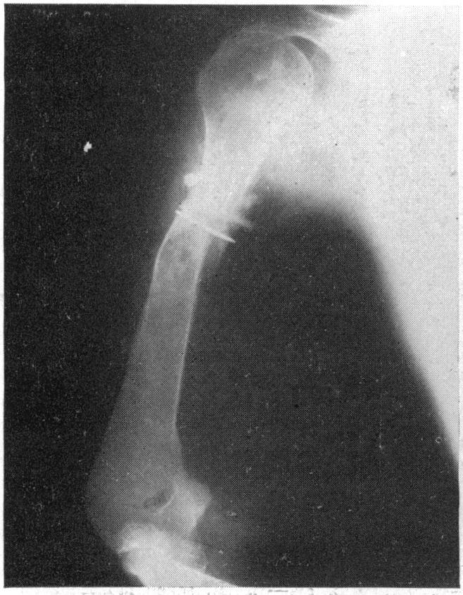 https://cdn.ncbi.nlm.nih.gov/pmc/blobs/a4cb/1391244/10aa1085daa7/annsurg00543-0145-c.jpg