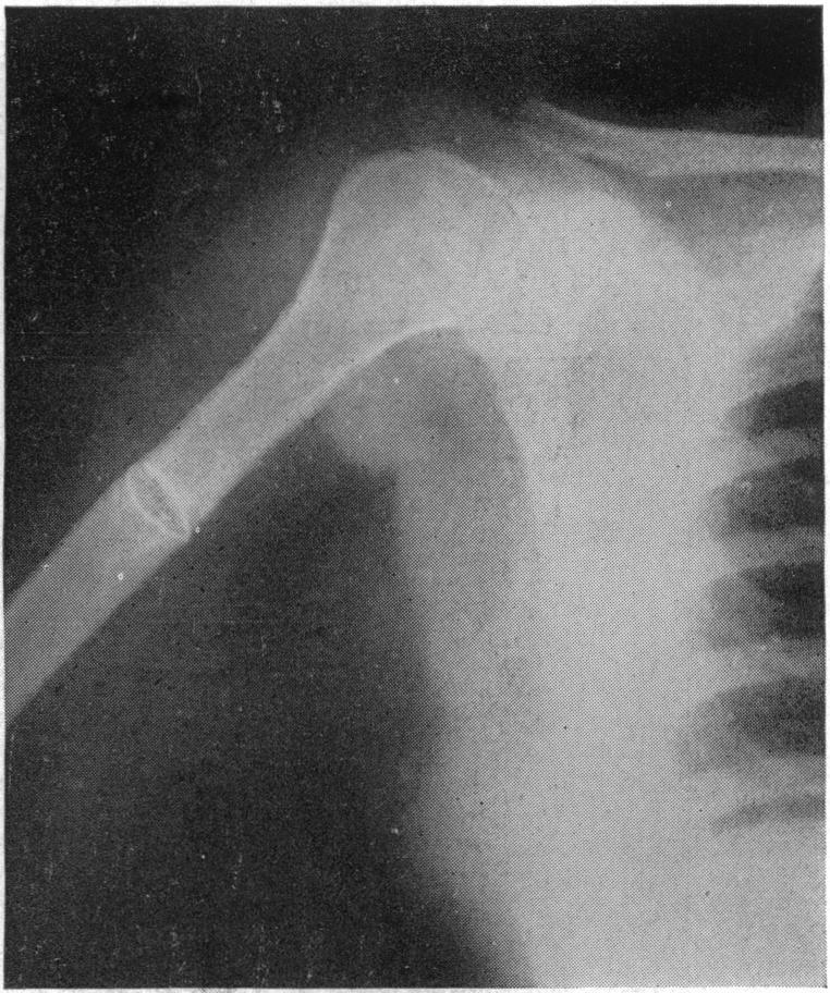 https://cdn.ncbi.nlm.nih.gov/pmc/blobs/a4cb/1391244/4da701999eb3/annsurg00543-0140-d.jpg