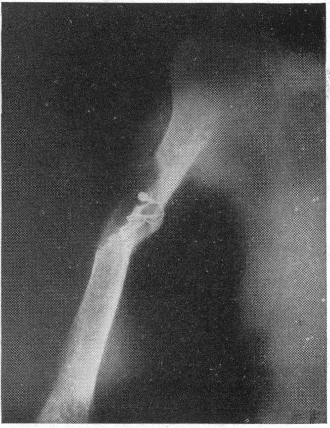 https://cdn.ncbi.nlm.nih.gov/pmc/blobs/a4cb/1391244/dae96dbc90c7/annsurg00543-0145-b.jpg