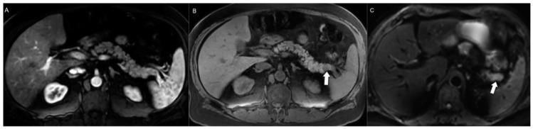 https://cdn.ncbi.nlm.nih.gov/pmc/blobs/a4cc/11172657/f9599c1b29af/jcm-13-03281-g006.jpg