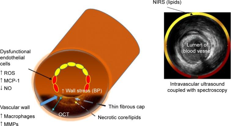 https://cdn.ncbi.nlm.nih.gov/pmc/blobs/a4cf/5422533/dc16a0e7a2c0/tcrm-13-603Fig5.jpg