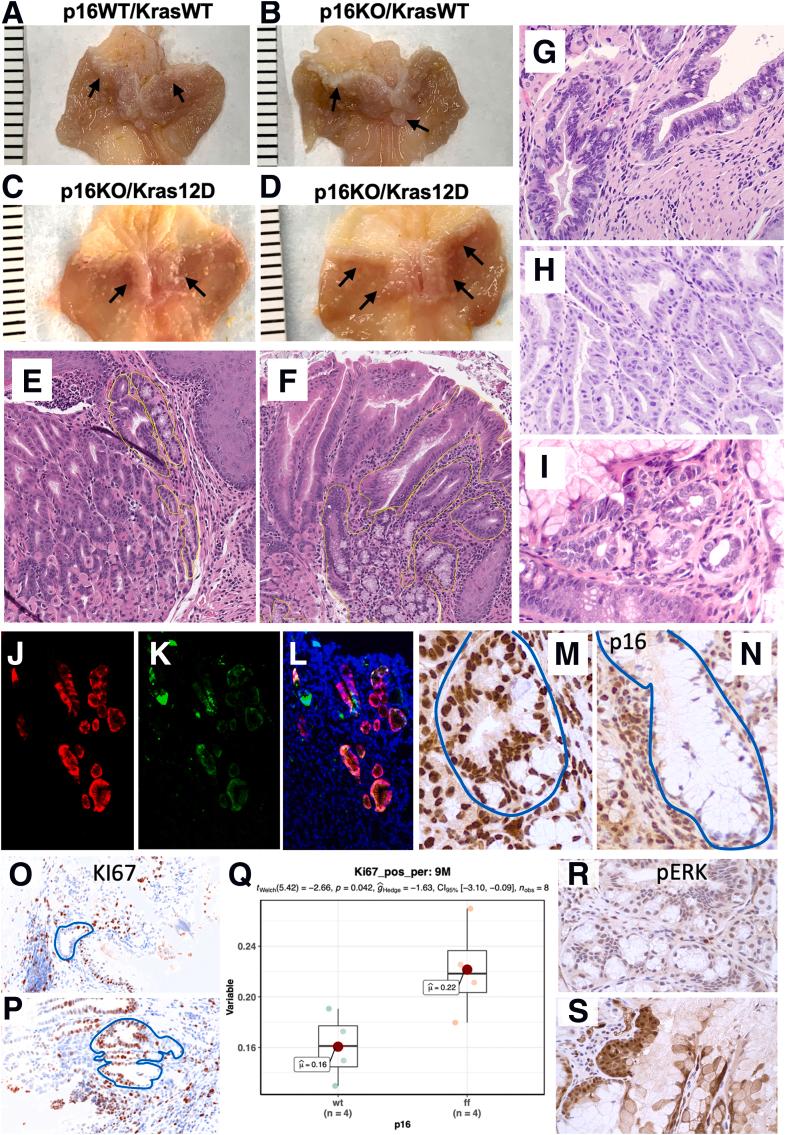 https://cdn.ncbi.nlm.nih.gov/pmc/blobs/a4d1/10966774/e68bb6ef9446/gr1.jpg