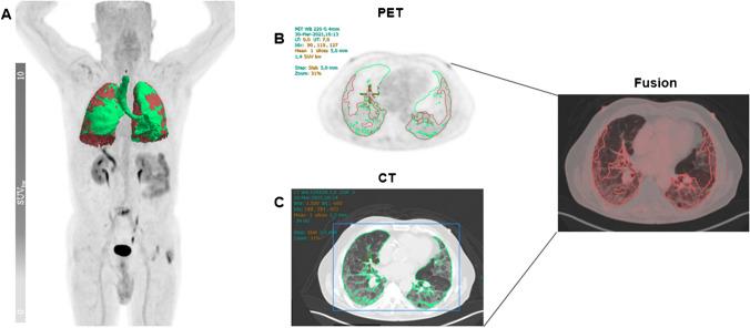 https://cdn.ncbi.nlm.nih.gov/pmc/blobs/a4d4/11043111/9f81df826a9c/259_2023_6564_Fig2_HTML.jpg