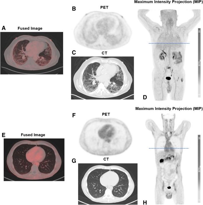https://cdn.ncbi.nlm.nih.gov/pmc/blobs/a4d4/11043111/c74b55d497c2/259_2023_6564_Fig1_HTML.jpg