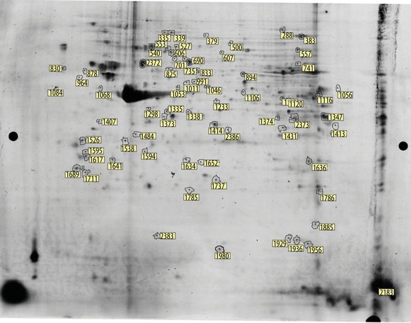https://cdn.ncbi.nlm.nih.gov/pmc/blobs/a4d6/4548697/d4ab2ac1ba17/medscimonit-21-419-g002.jpg